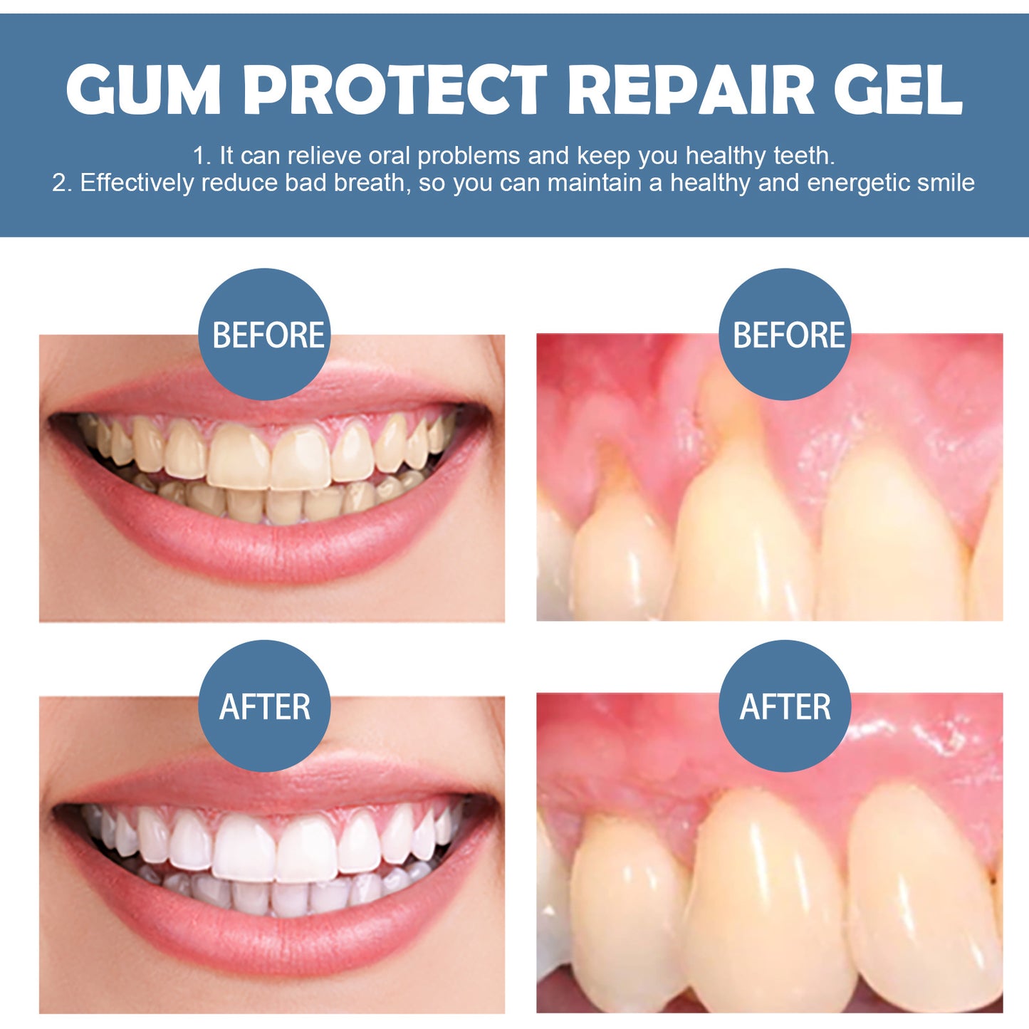 Boueach Gingival Repair gel Deep Cleaning Tooth Dirt Care Gingival Fresh Breath Care gel