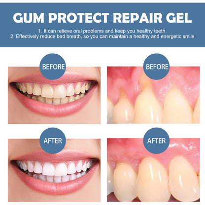 Boueach Gingival Repair gel Deep Cleaning Tooth Dirt Care Gingival Fresh Breath Care gel